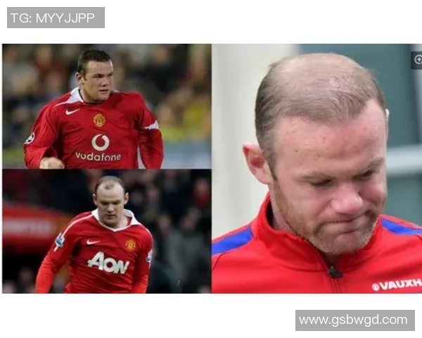 足球明星植发成功逆袭发际线重塑自信与风采的传奇之路 足球明星植发成功逆袭发际线重塑自信与风采的传奇之路